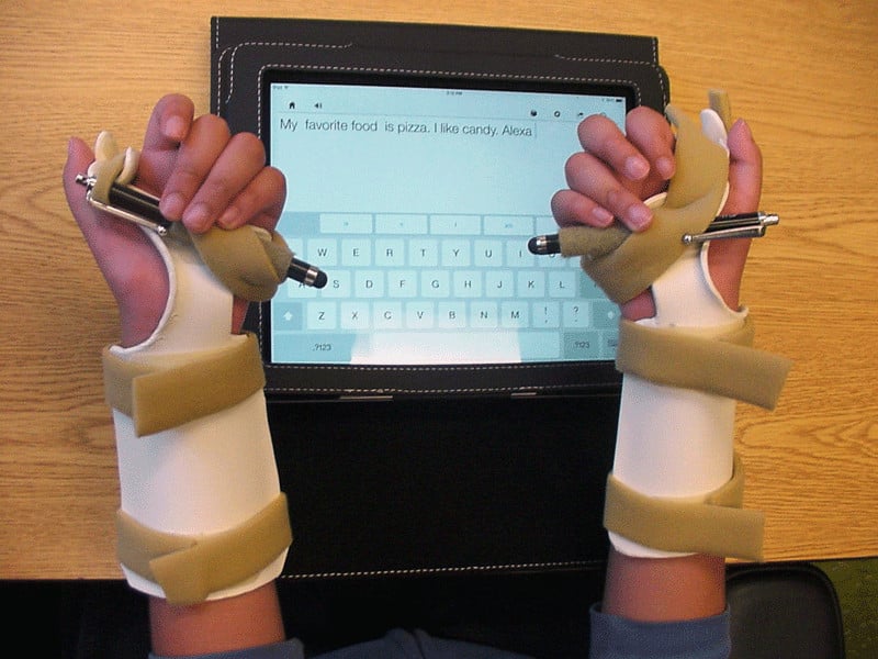 Student with bilateral splints for stylus to access an AT device.
